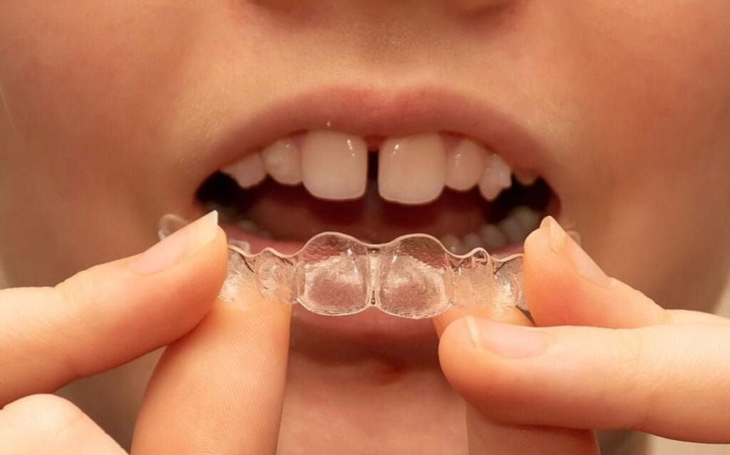 does invisalign treatment hurt